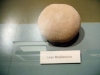 bladder_stone.jpg